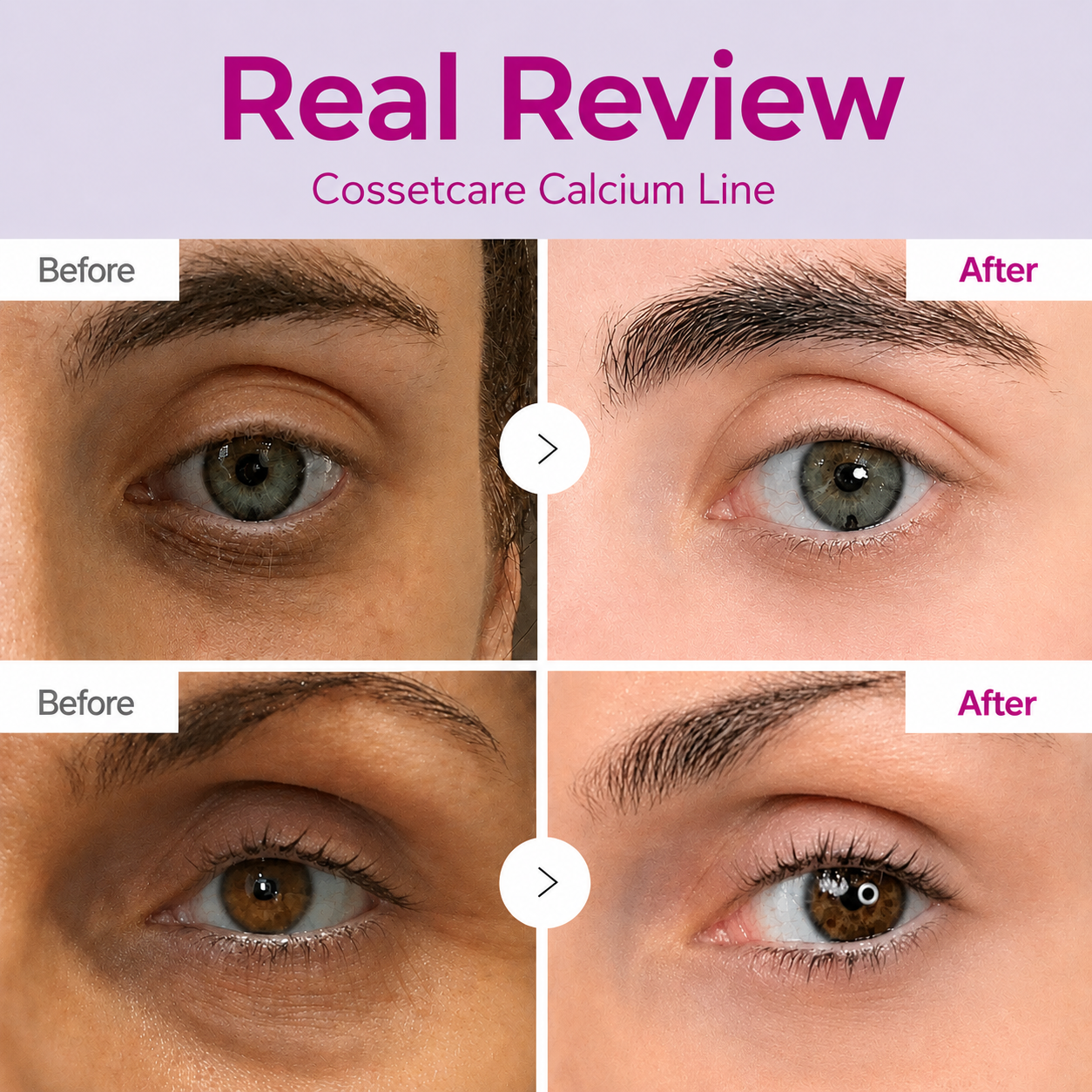🔥LAST DAY 50% OFF!!Taffat Korean Calcium Dark Spot Eye Cream