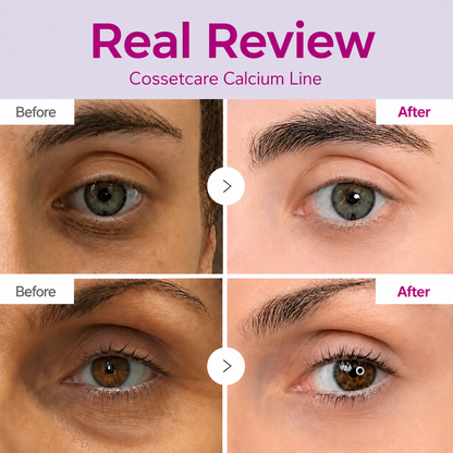 🔥LAST DAY 50% OFF!!Taffat Korean Calcium Dark Spot Eye Cream
