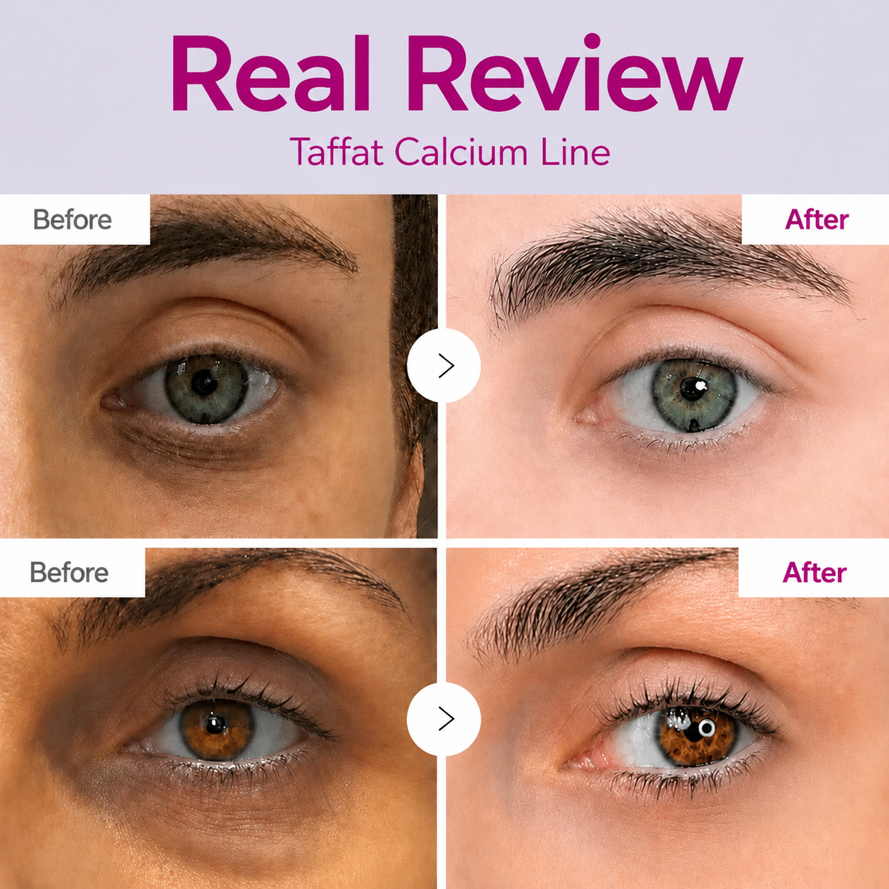 🔥LAST DAY 50% OFF!!Taffat Korean Calcium Dark Spot Eye Cream